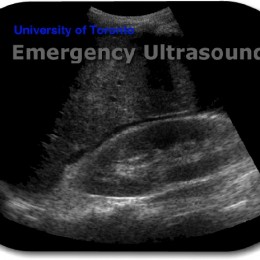 Sunnybrook Emergency Ultrasound Fellowship